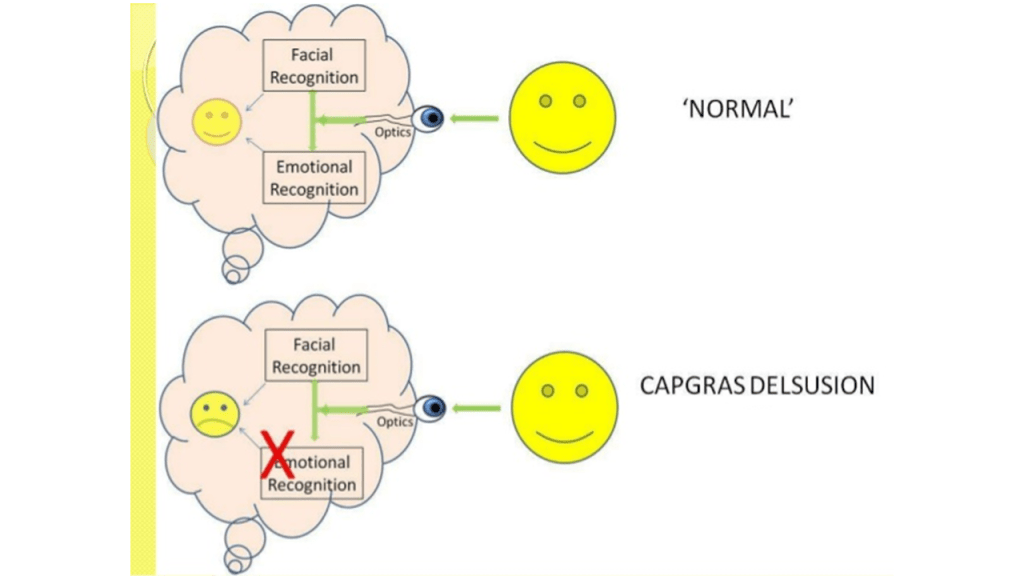 Capgras Syndrome Explanation